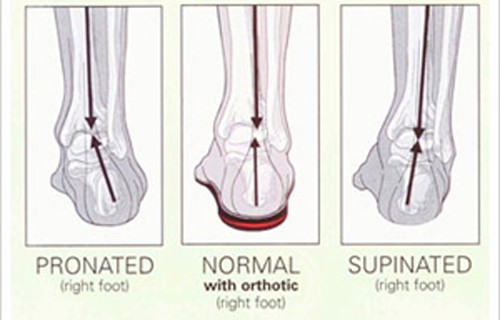 Pronated, normal and supinated ancle